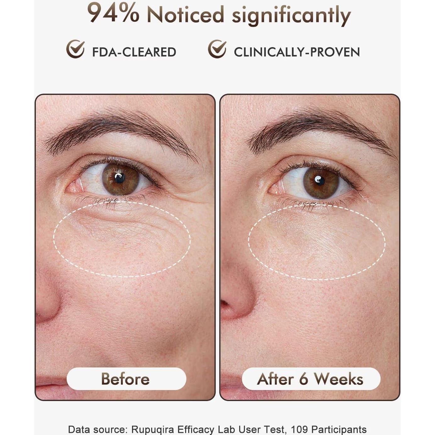 Máscara Facial de Terapia de Luz LED Rupuqira G3 - 4 Modos