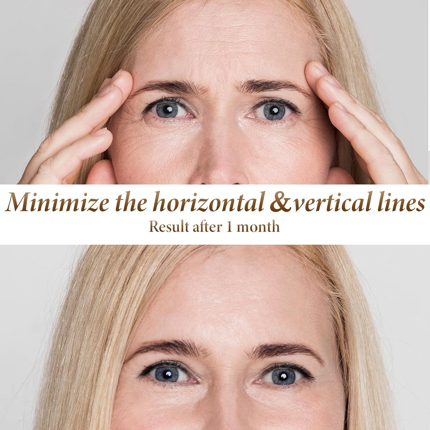 Máscara de Terapia de Luz Roja NEWKEY A38-1 para Antienvejecimiento