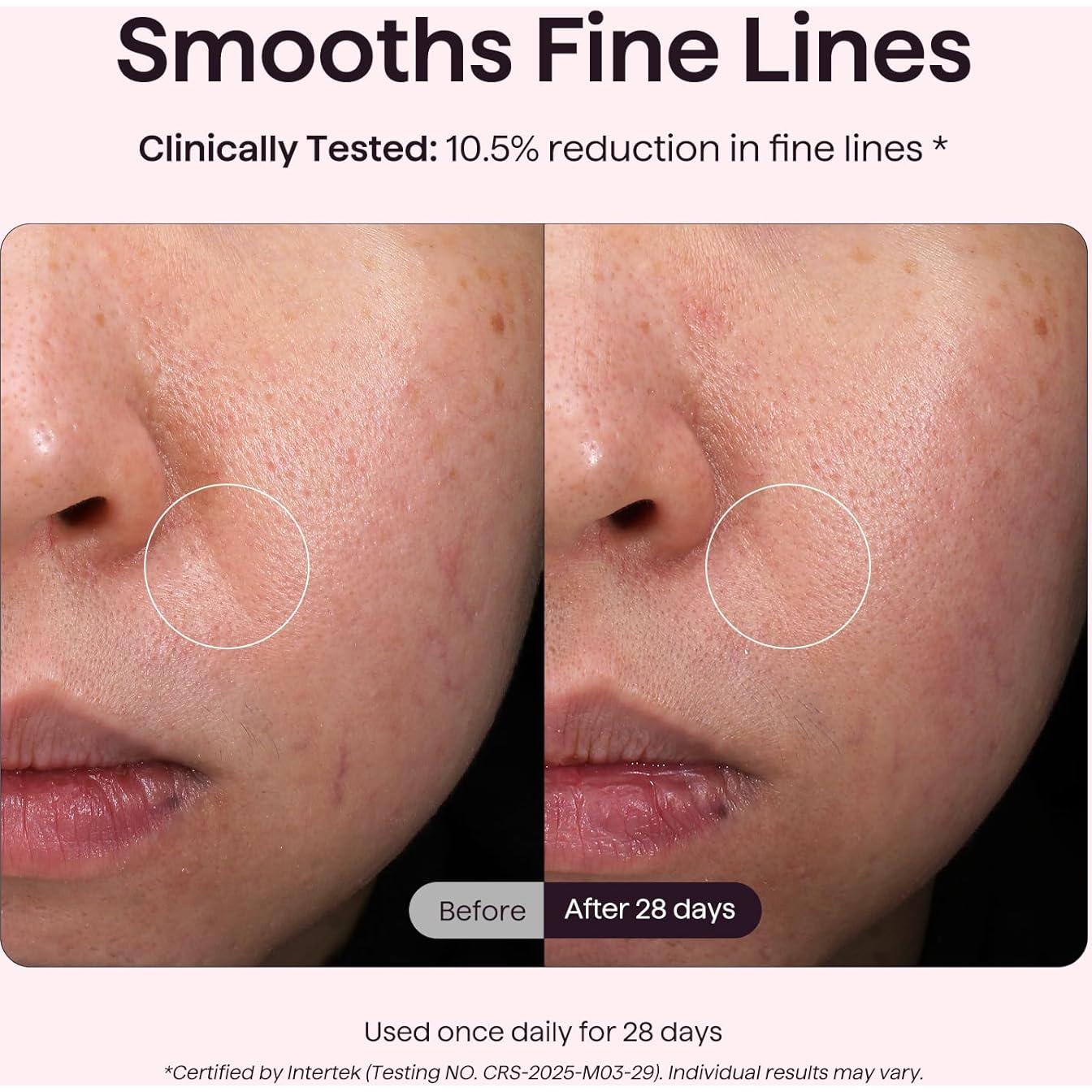 Máscara de Terapia de Luz LED Wavytalk para Rejuvenecimiento Facial