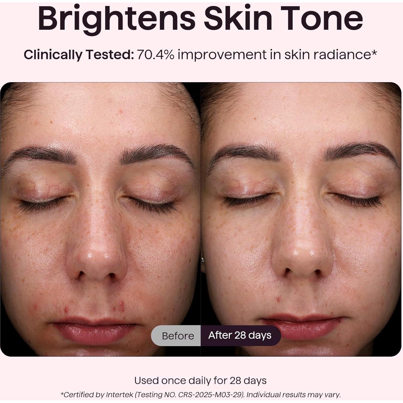 Máscara de Terapia de Luz LED Wavytalk para Rejuvenecimiento Facial