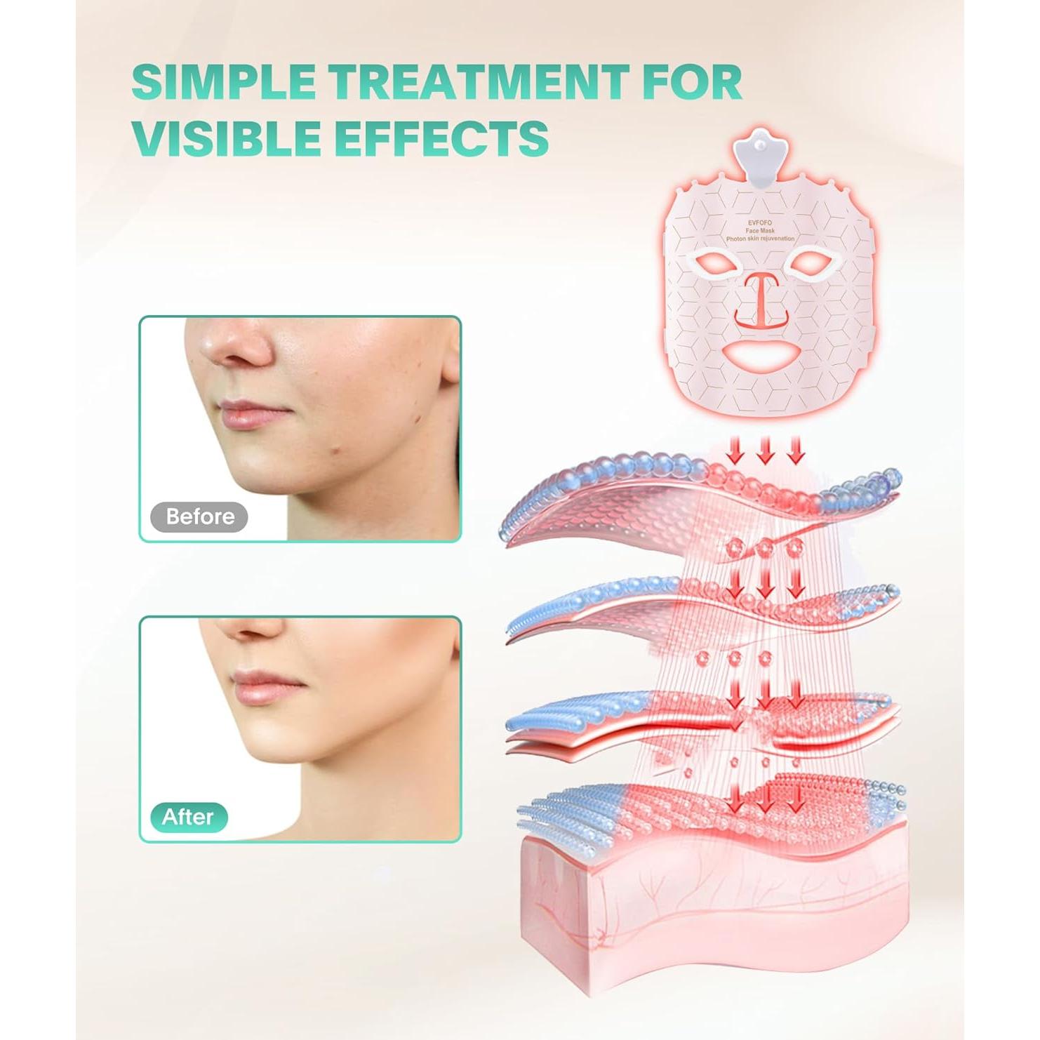 Máscara de Terapia de Luz LED 7 Colores Rosa - Shenzhen Liyoutong