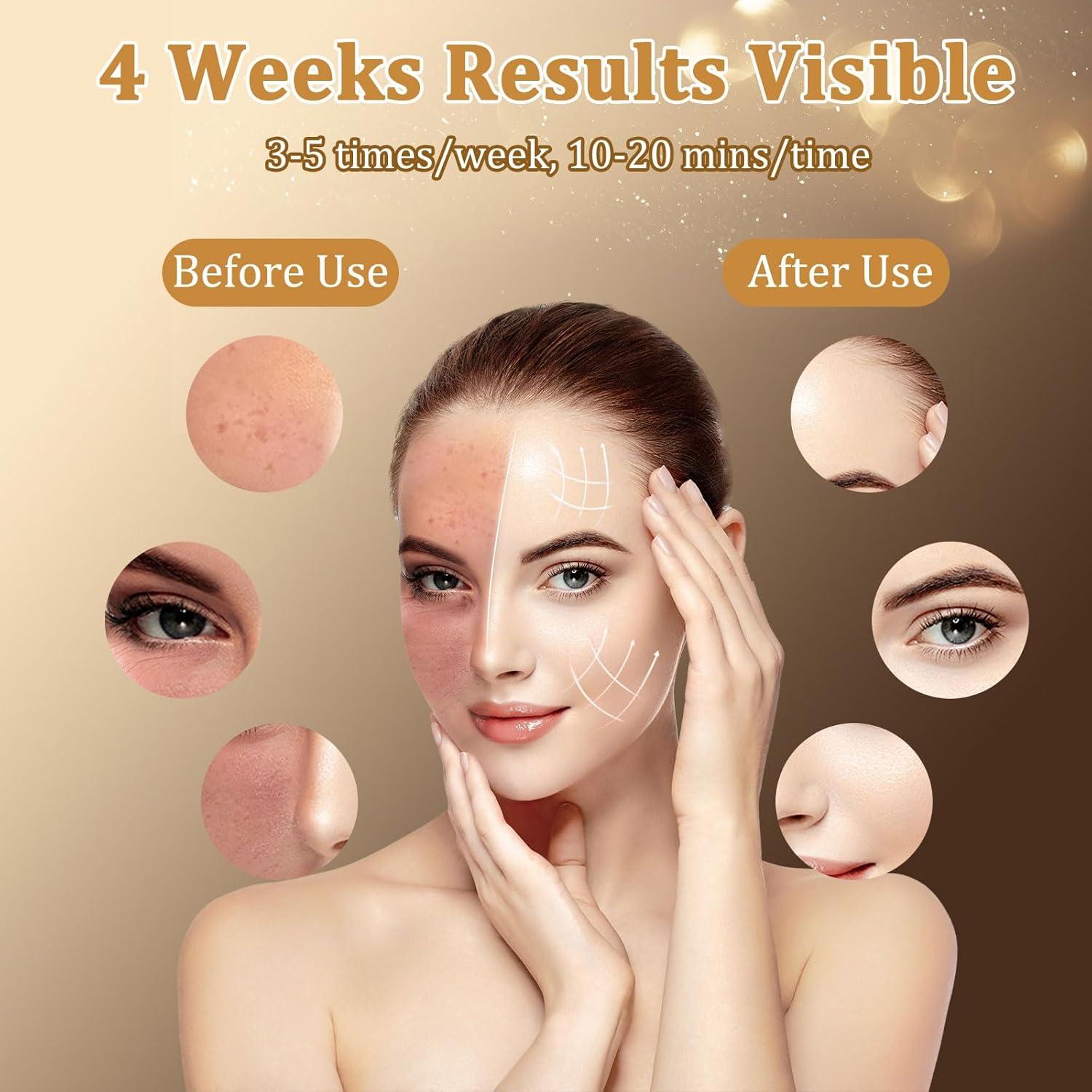 Máscara de Terapia de Luz LED biuufish 8 Colores 850nm Infrarrojo