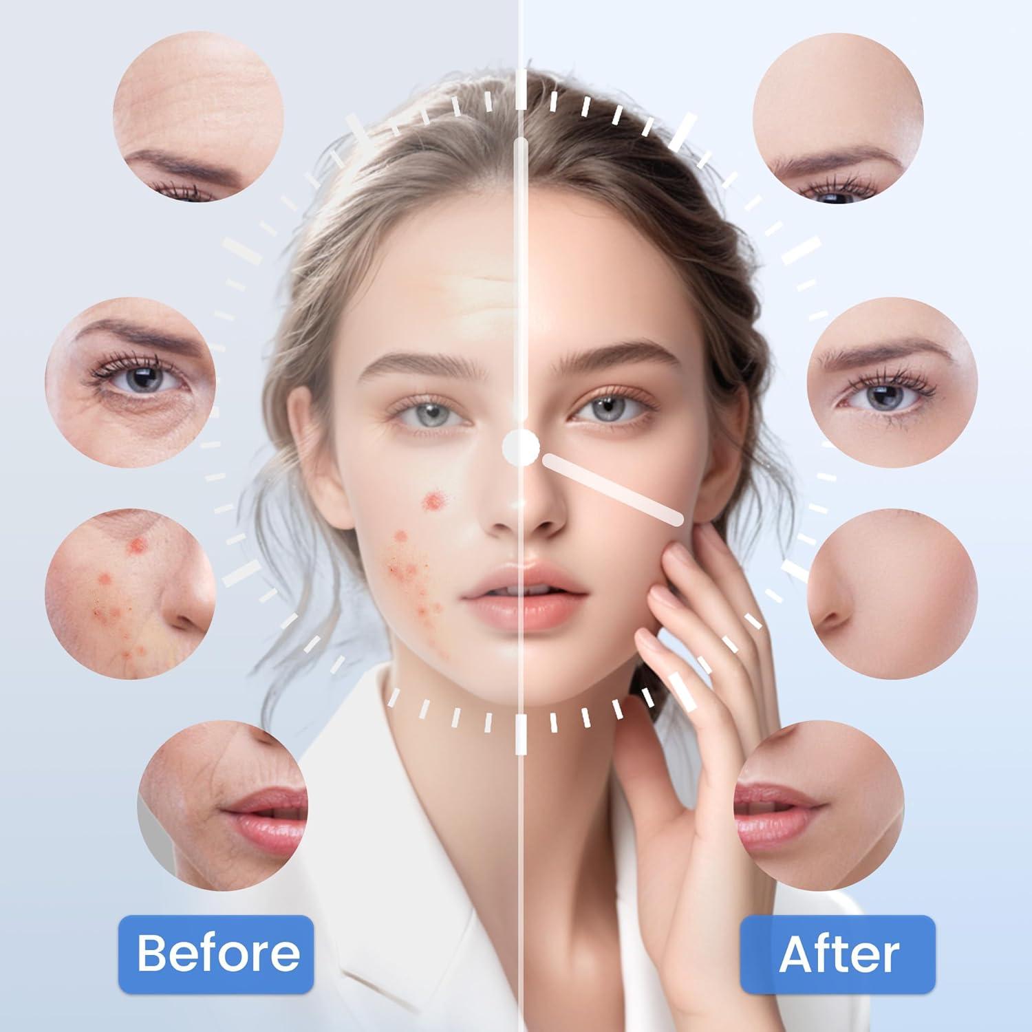 Máscara de Terapia de Luz Roja LED Possday con Compresa Fría