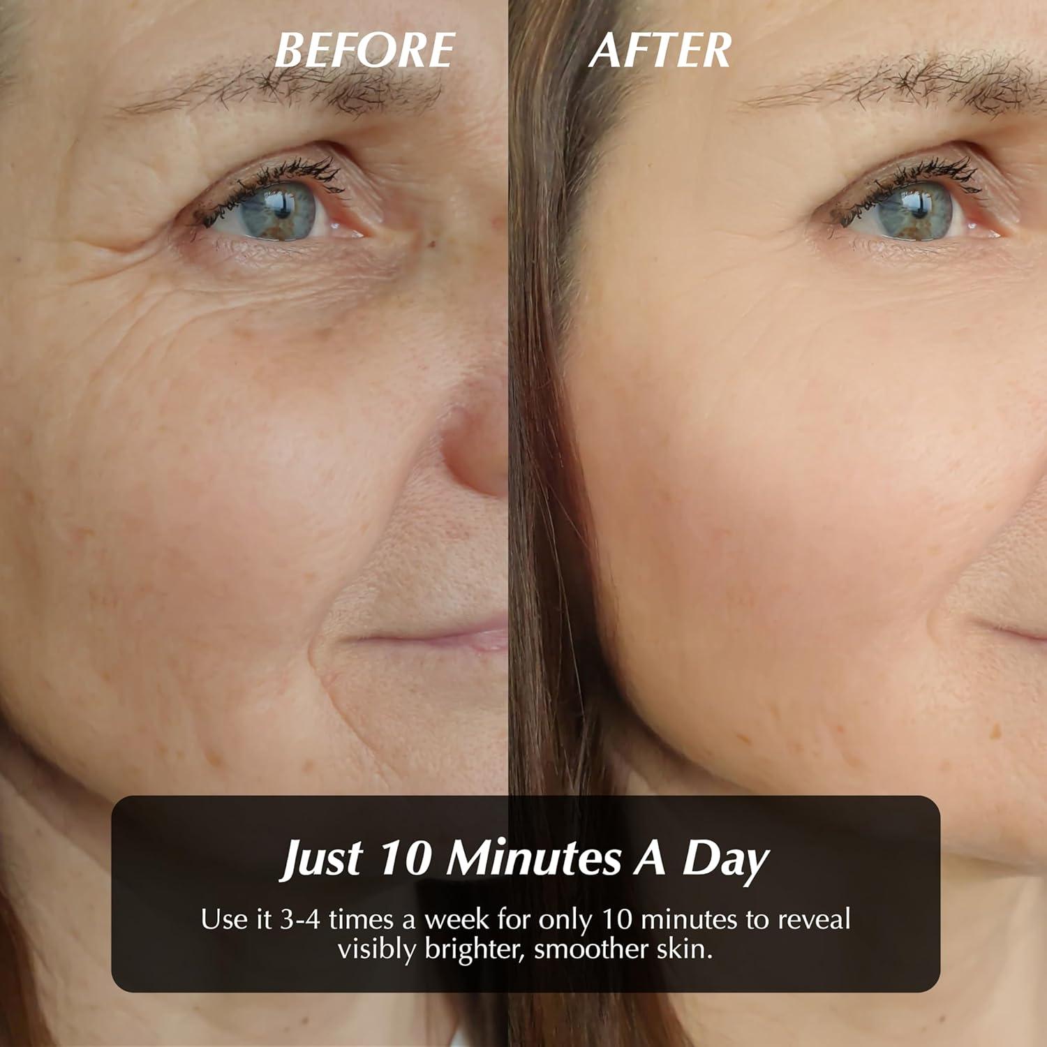 Máscara de Terapia de Luz LED Vital Glow - Antienvejecimiento