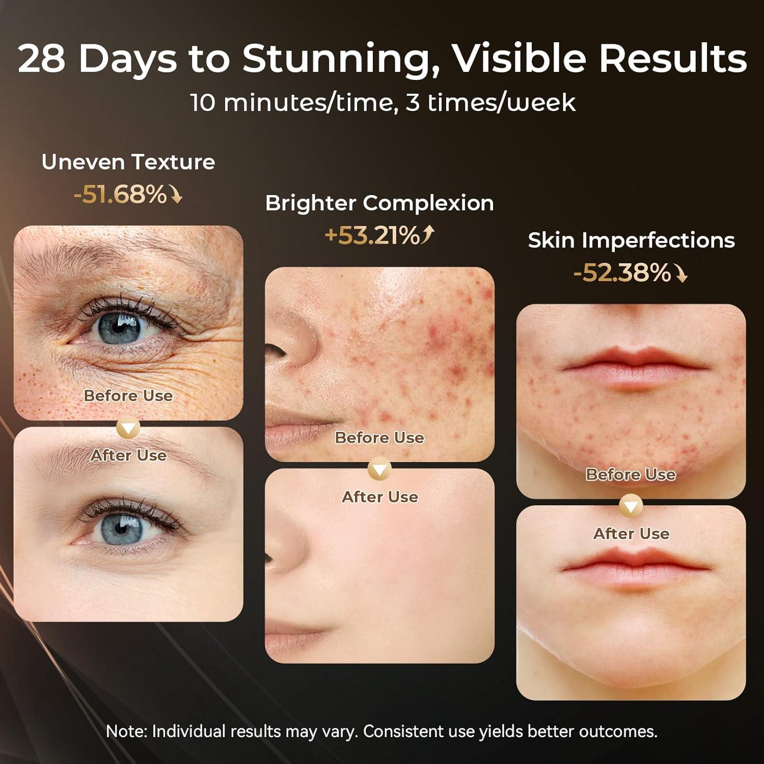 Máscara de Terapia de Luz Roja LED ONLUKY 3 Niveles 2500mAh