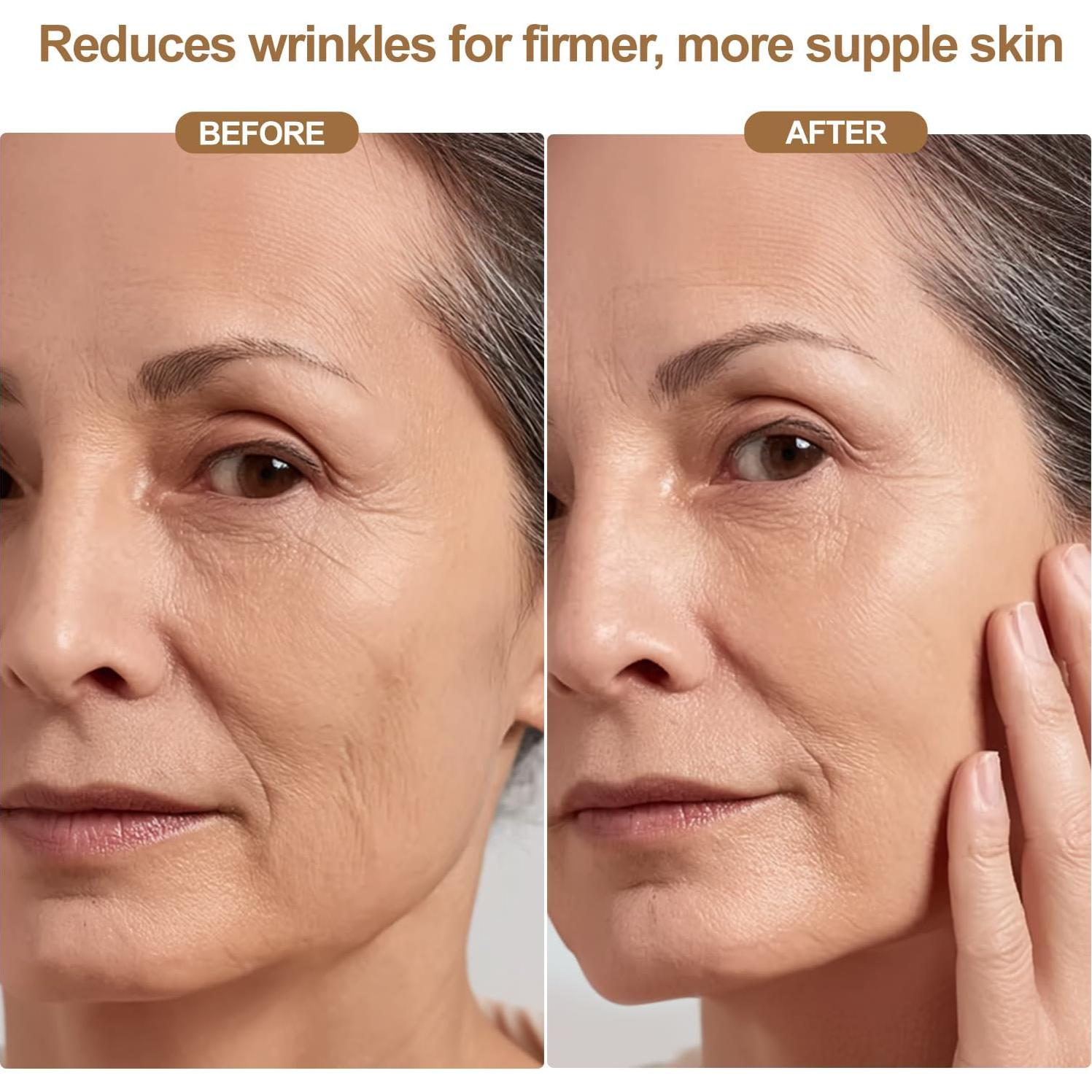 Máscara de Terapia de Luz Roja LED Inalámbrica 850nm - Cuidado Facial