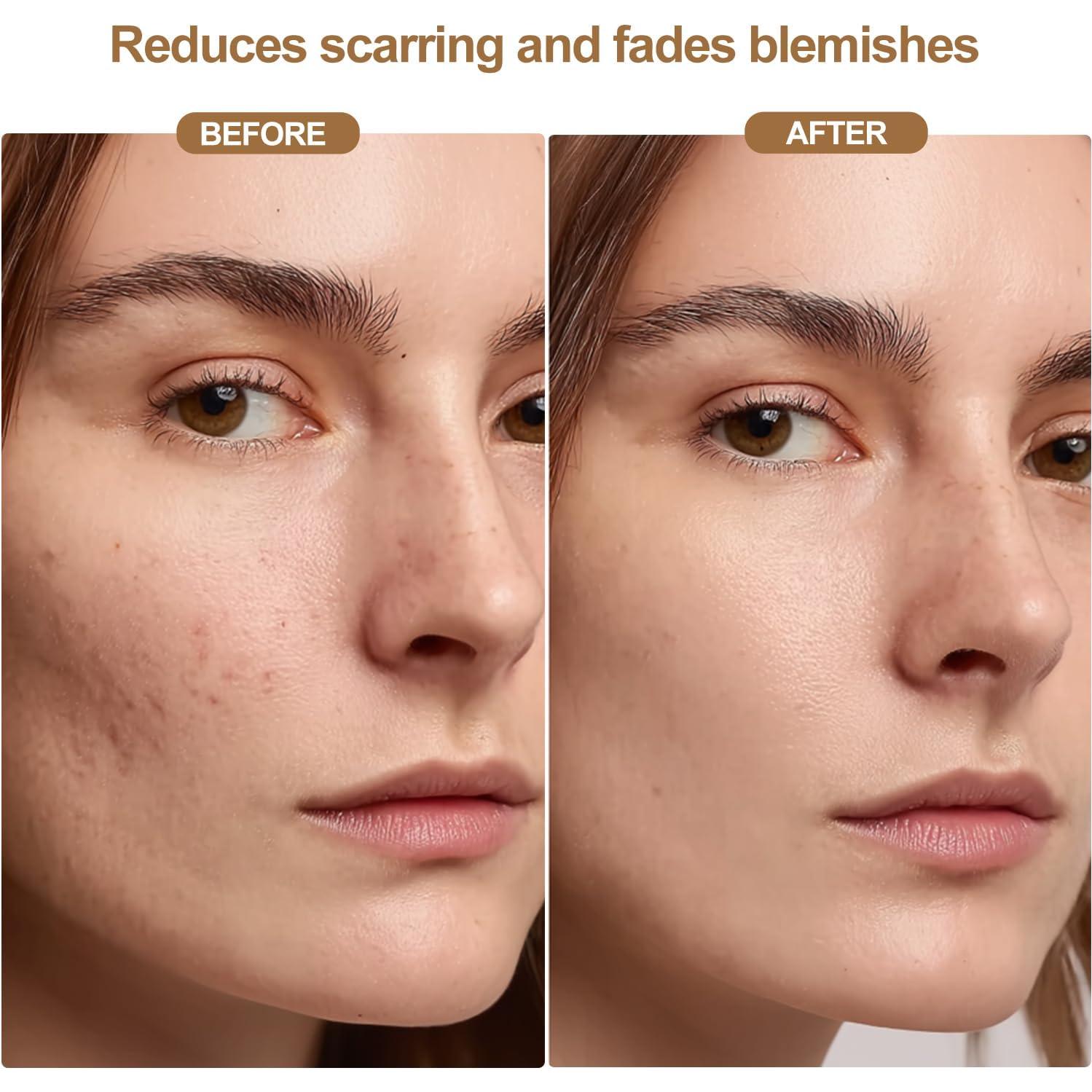 Máscara de Terapia de Luz Roja LED Inalámbrica 850nm - Cuidado Facial