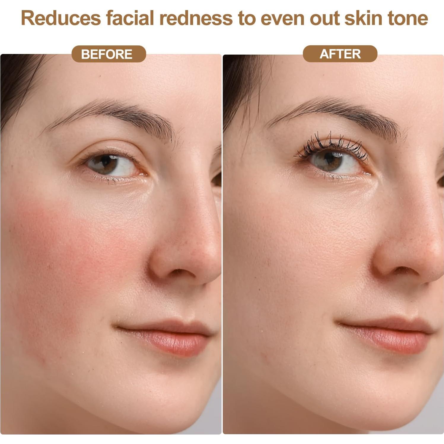 Máscara de Terapia de Luz Roja LED Inalámbrica 850nm - Cuidado Facial