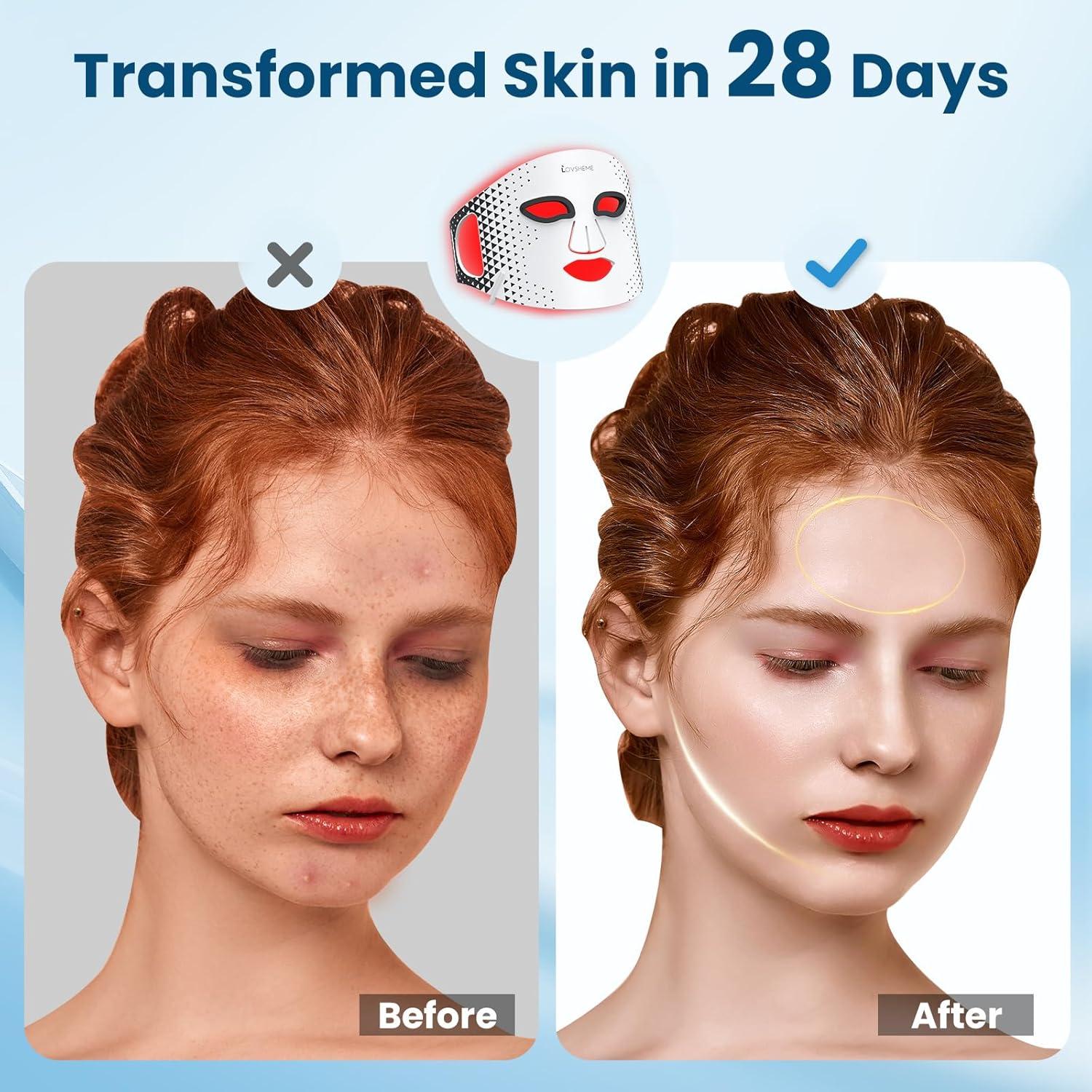 Máscara de Terapia de Luz LED Lovsheme T1 para Piel Radiante