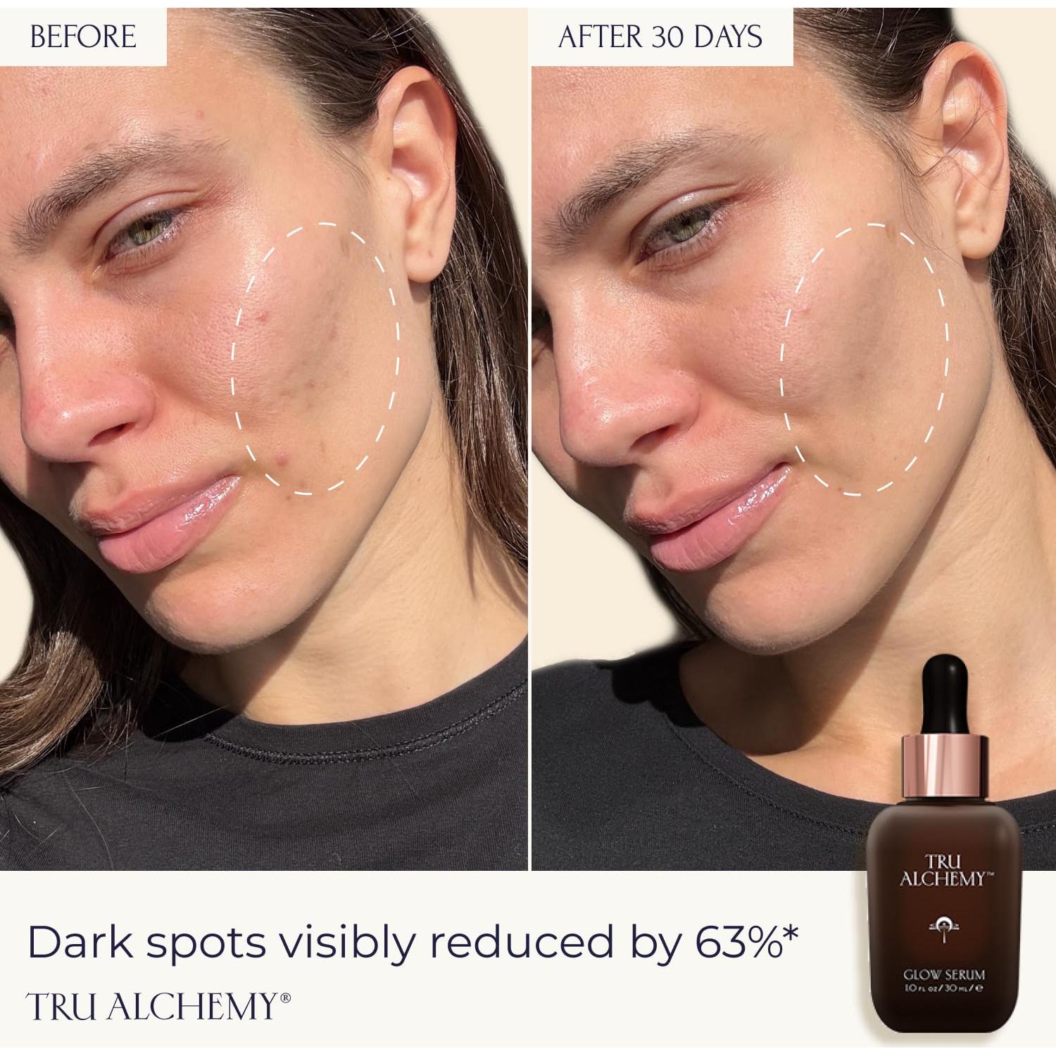 Suero Facial Hidratante Tru Alchemy 29.57 ml - Vitamina C