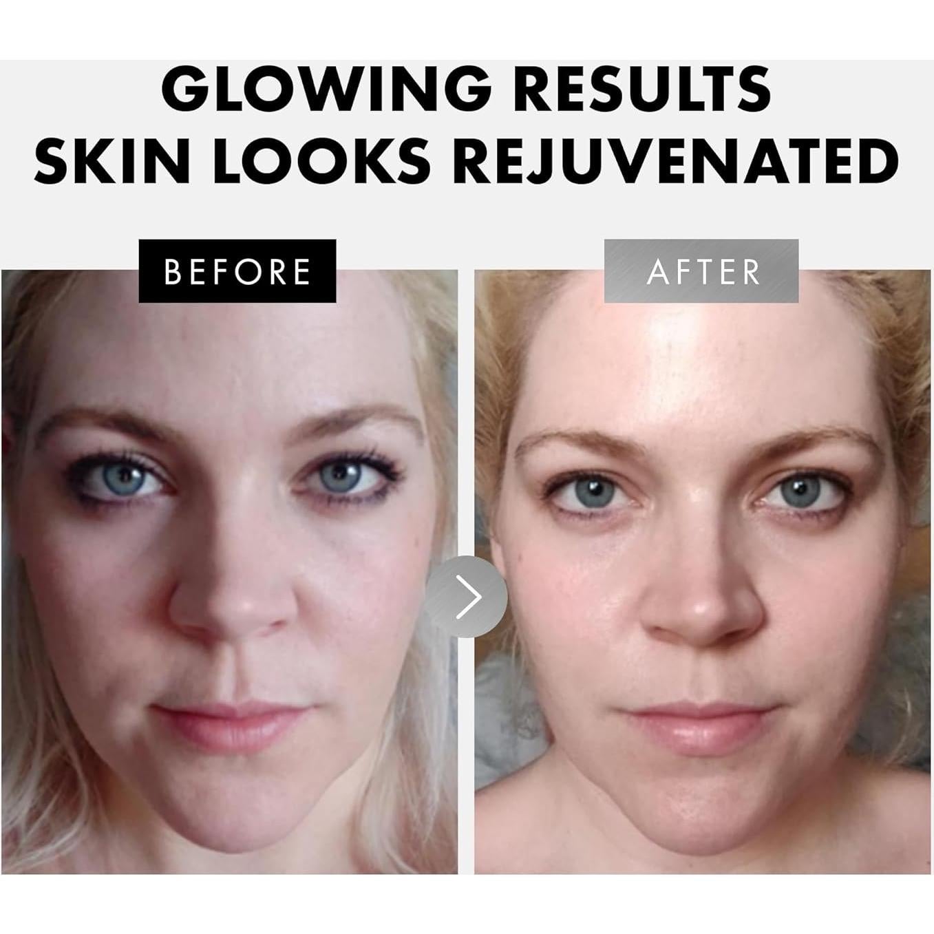 Set de Sueros Faciales Eclat Skincare - Vitamina C, Retinol y Ácido Hialurónico