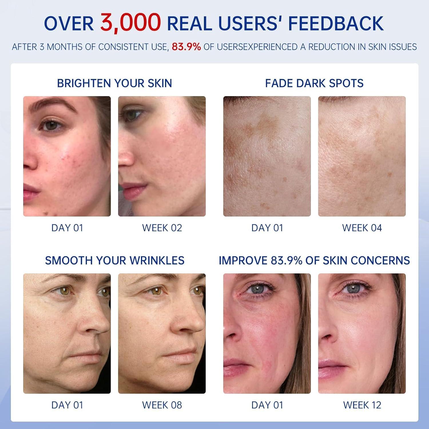 Suero Facial 2-en-1 FLYLEAF Vitamina C y Retinol 159g