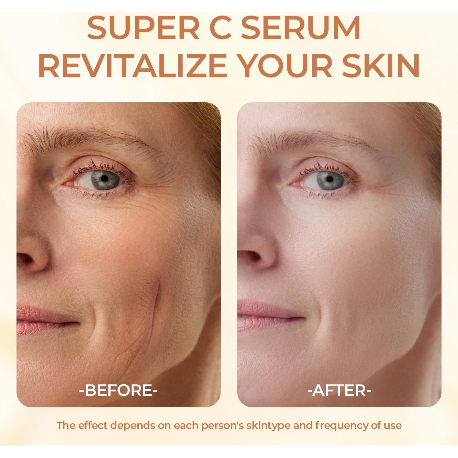 Sérum de Vitamina C Green Luxe 49.9 ml - Hidratante Antienvejecimiento