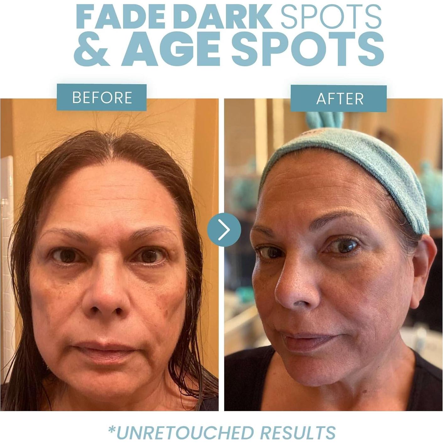 Suero Facial de Vitamina C Eva Naturals 20% - 29.57 ml