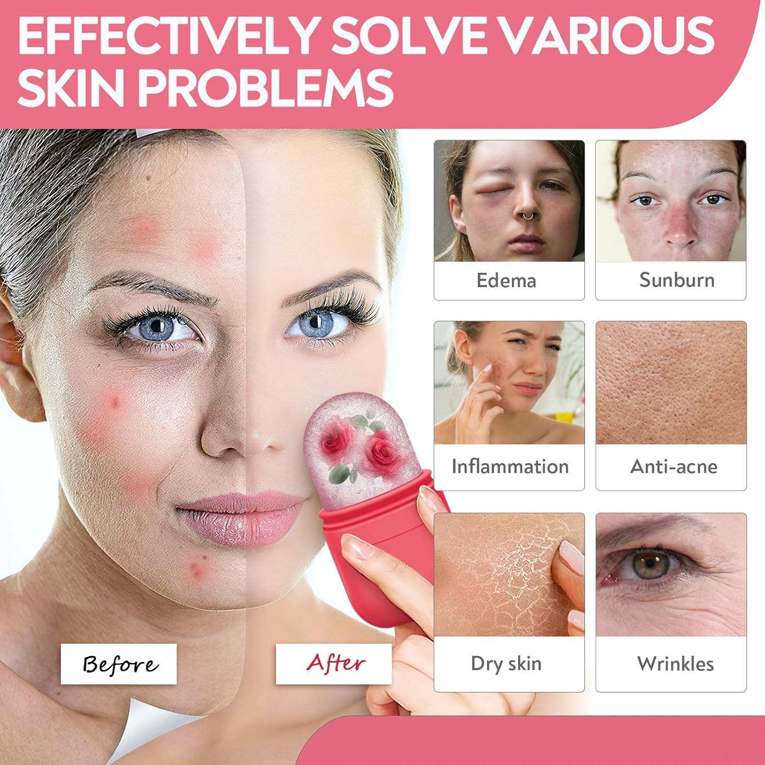 Rodillo de Hielo Facial AURUZA con Gua Sha - Cuidado de Piel