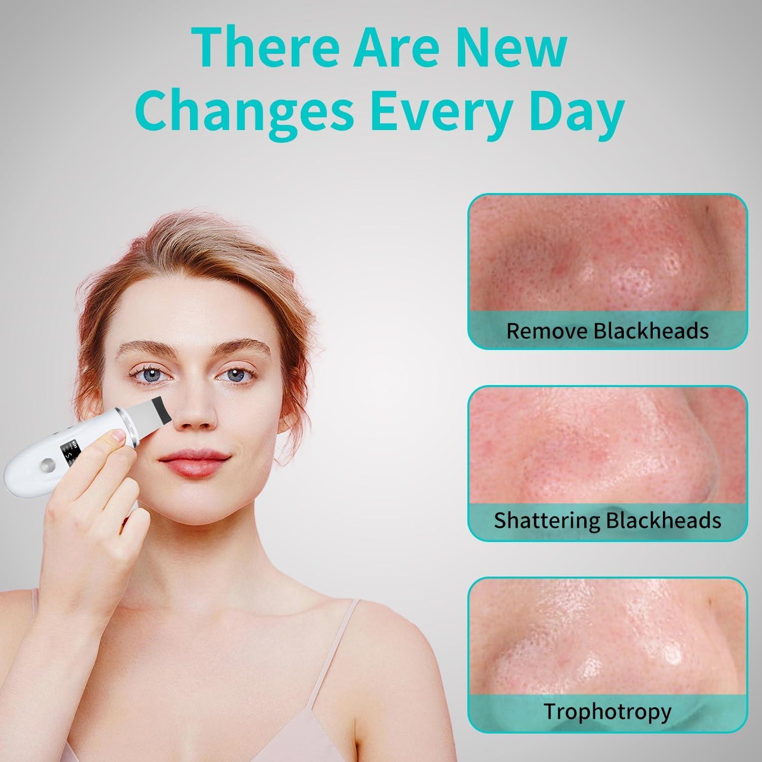 Espátula Facial QYCSL 4 en 1 - Limpieza Profunda y Exfoliación