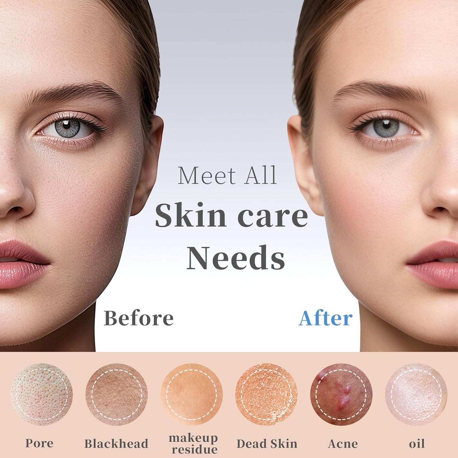 Removedor de Puntos Negros Sookga - Espátula Facial Verde