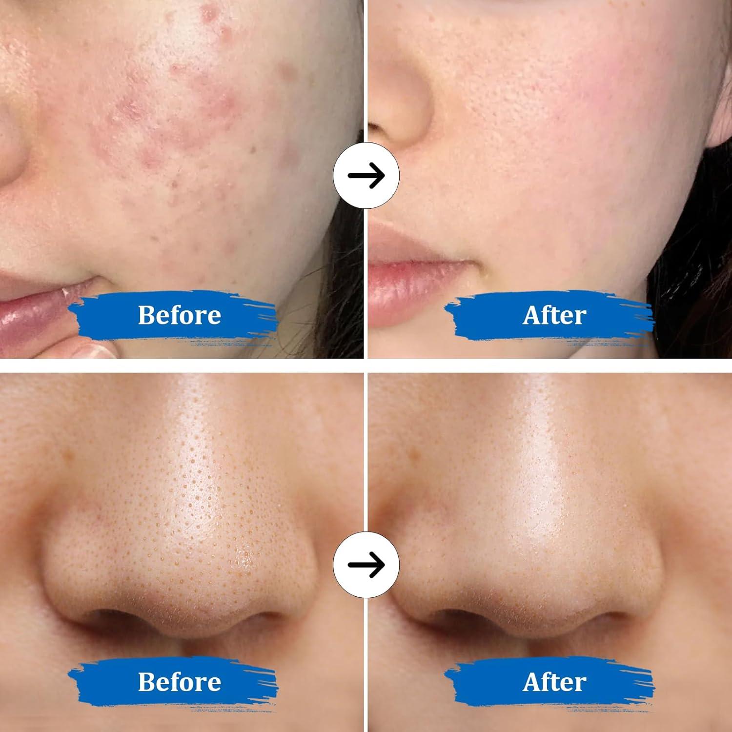 GUGUG Skin Scrubber 4-en-1 Espátula Facial Impermeable