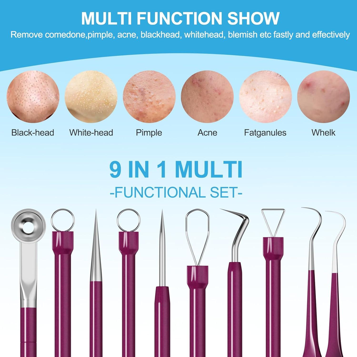 Kit de Herramientas para Puntos Negros UWOIST - 5 Piezas