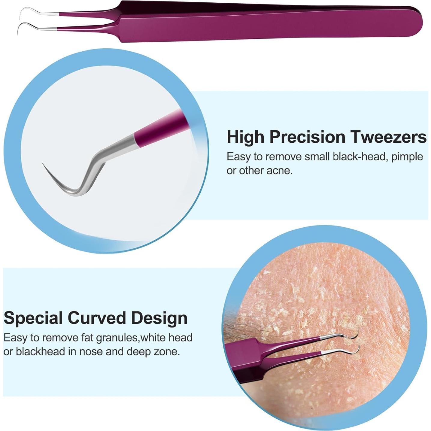Kit de Herramientas para Puntos Negros UWOIST - 5 Piezas