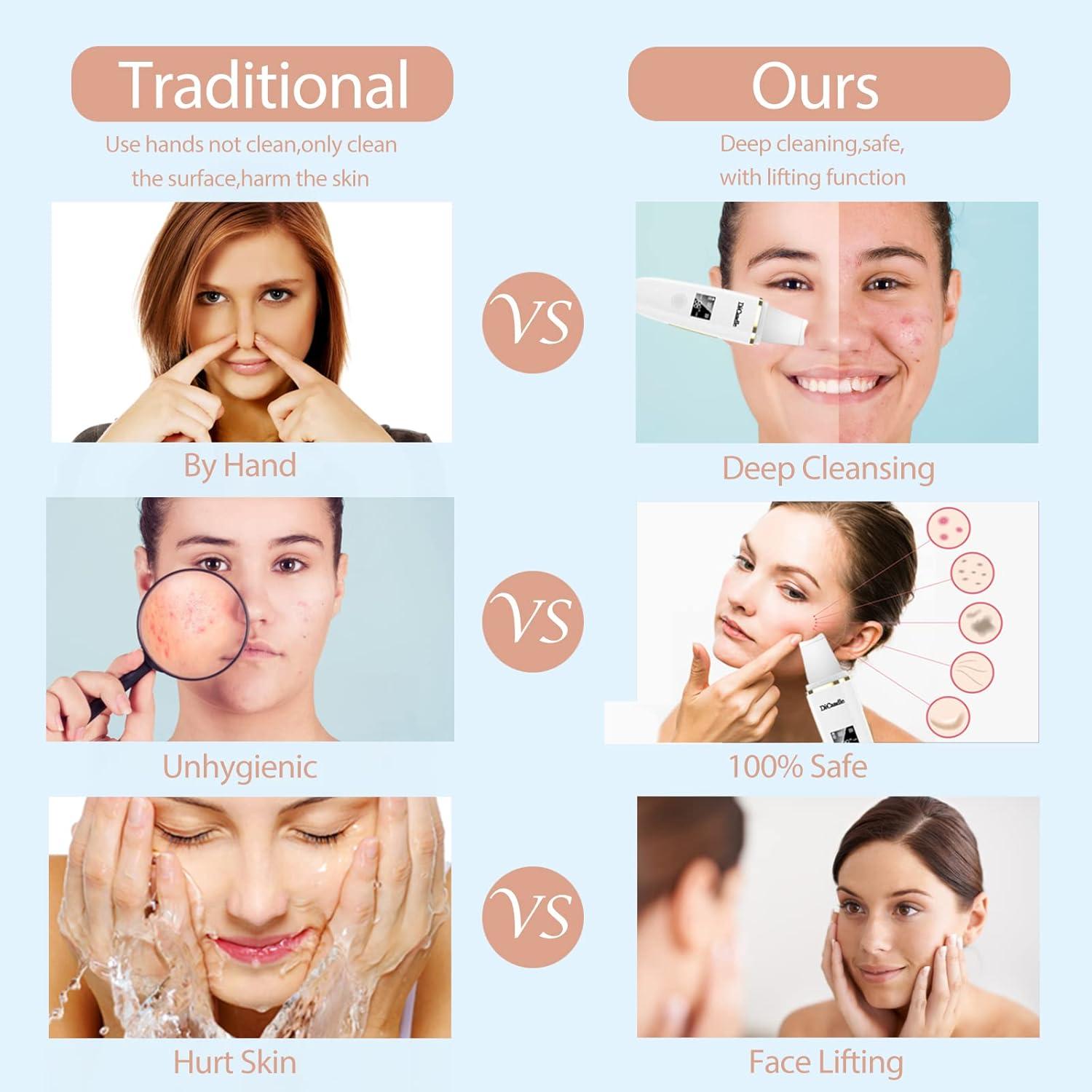 Limpiador Facial DiCandle Z9 Espátula LED 4 Modos Recargable