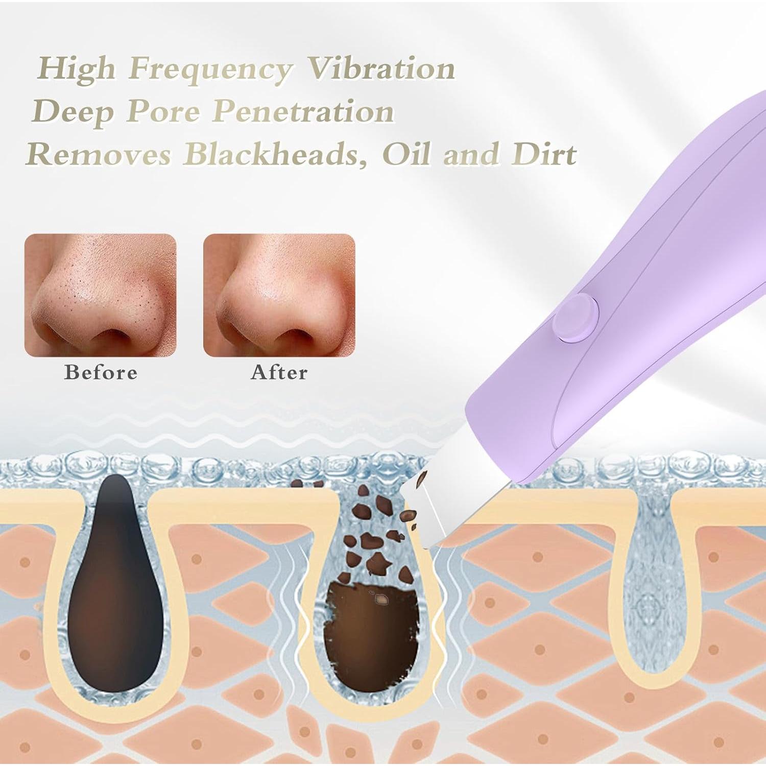 Raspador Facial Portátil Auioytoy K2405 - Eliminación de Puntos Negros