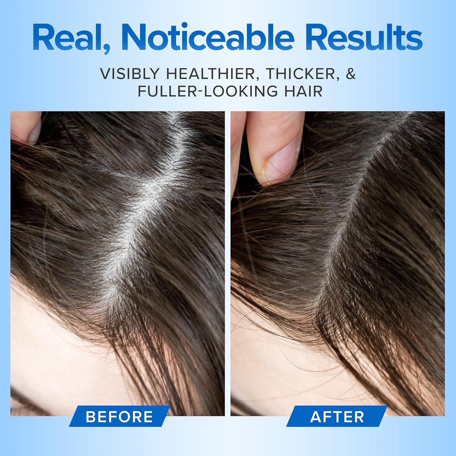 Champú y Acondicionador DermaChange 473ml - Crecimiento Cabello Grueso