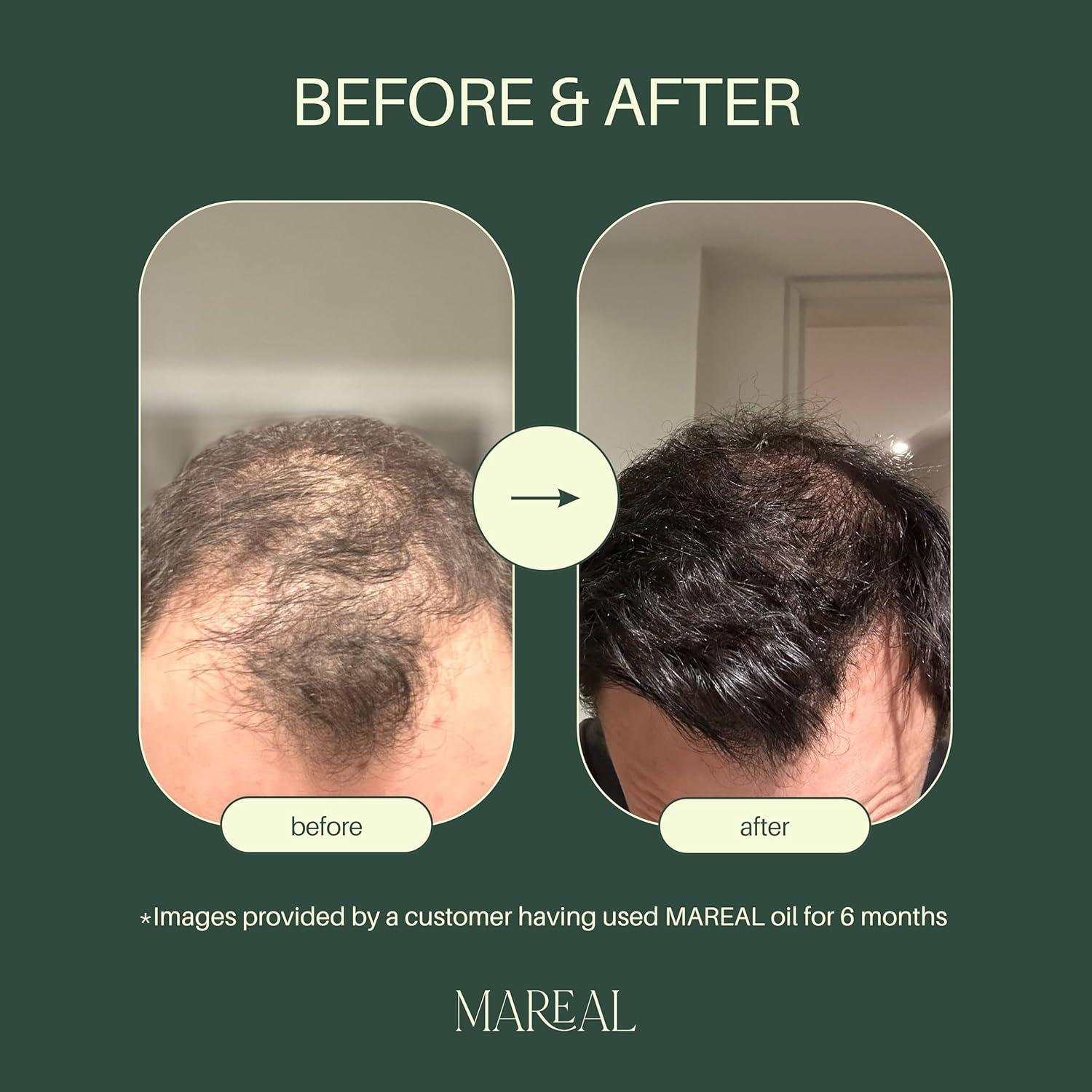 Aceite Puro de Romero Mareal 50 ml - Crecimiento y Salud Capilar