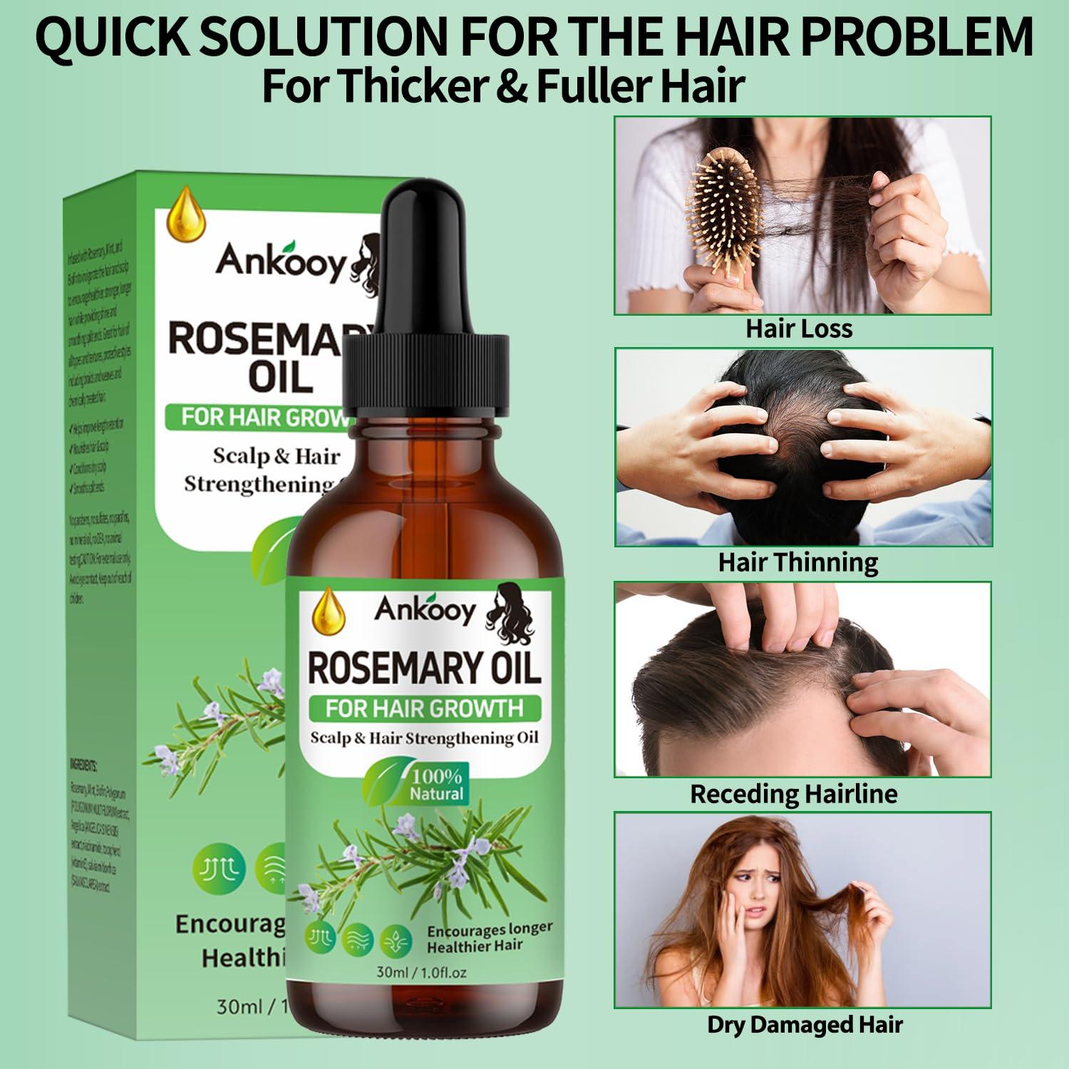 Aceite de Romero ANKOOY 3 Unidades para Crecimiento Cabello