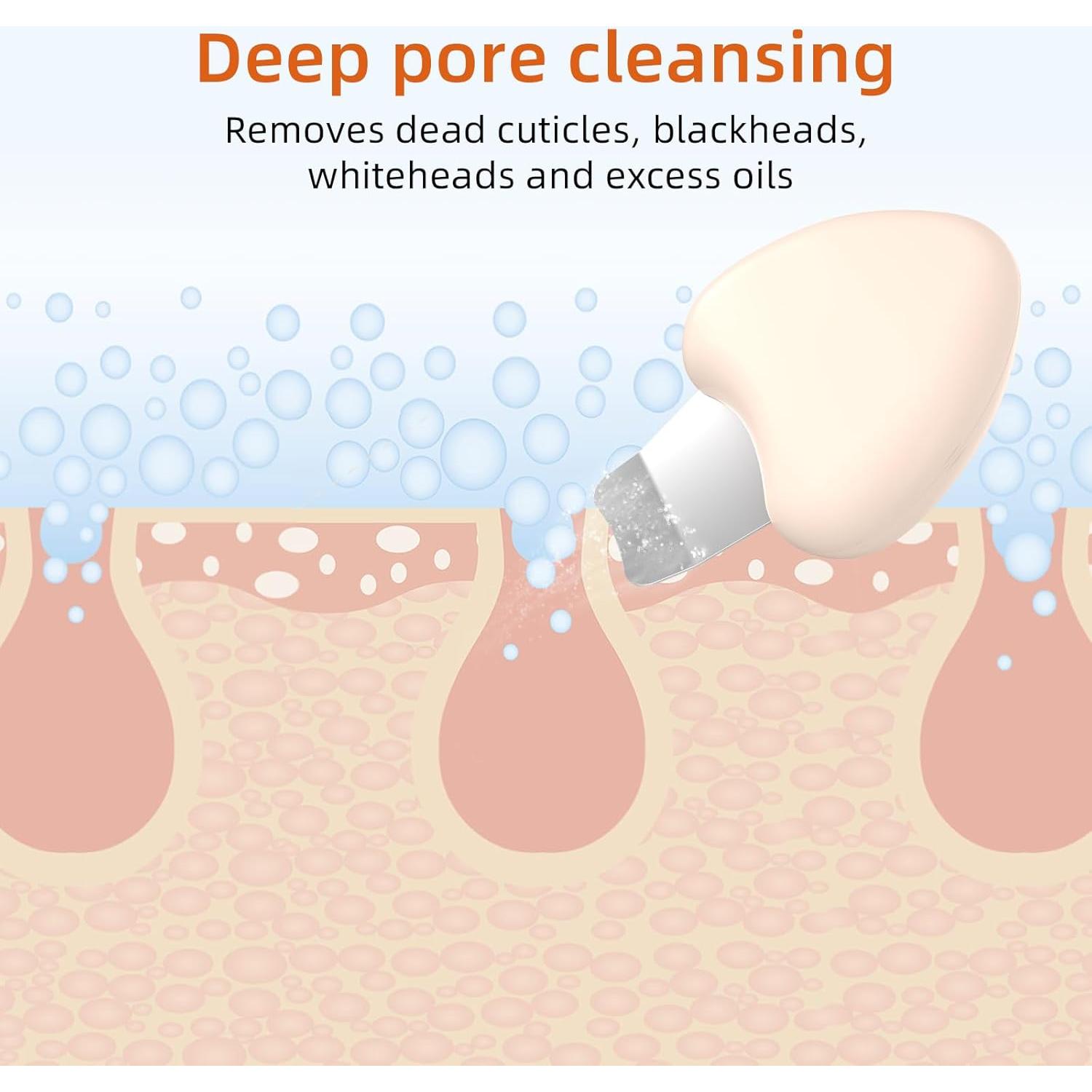 Raspador Facial Skin Scrubber Auioytoy - Limpiador de Poros