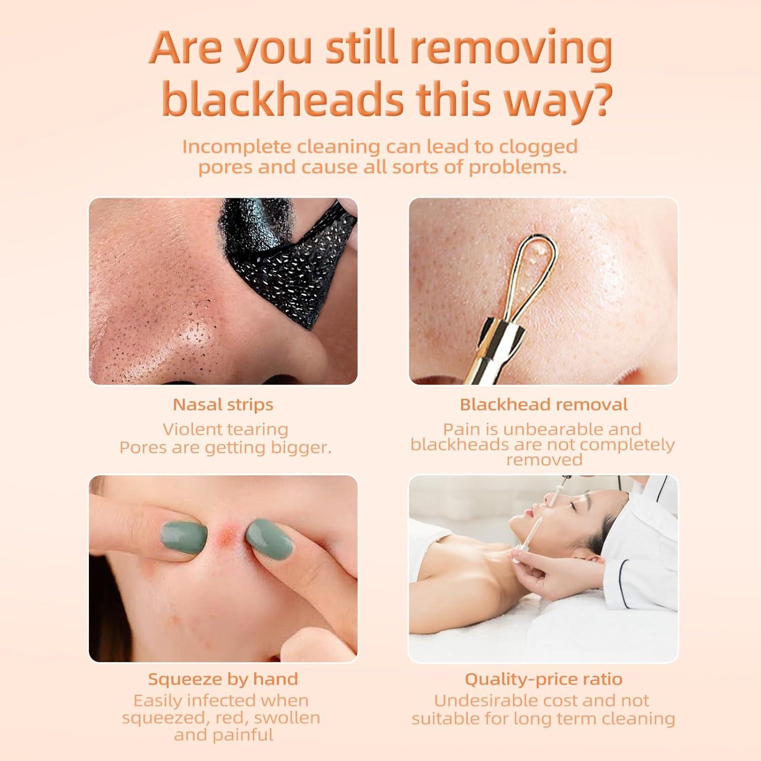 Raspador Facial Skin Scrubber Auioytoy - Limpiador de Poros