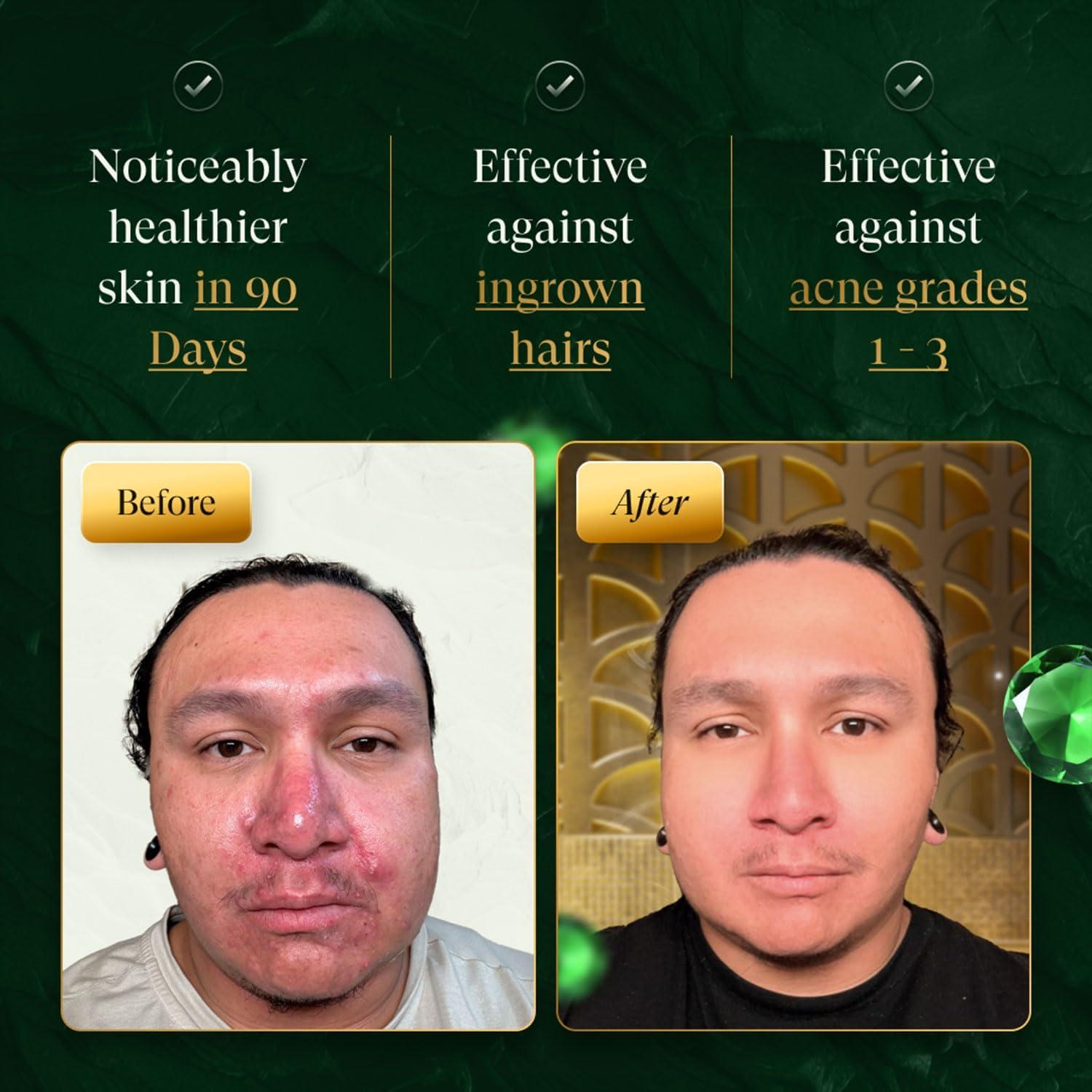 Cepillo Facial Vibrante Douxds FLEX Pro - Limpiador Eléctrico Masculino