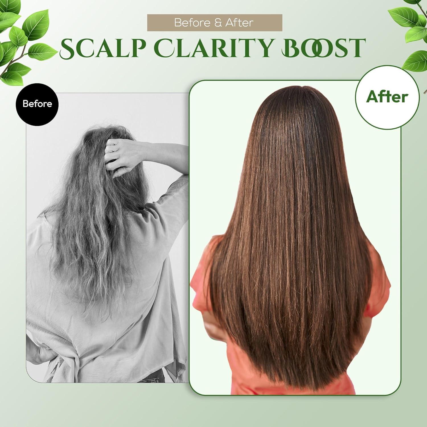 Juego de Champú y Acondicionador Sin Sulfatos SARABiO 760g