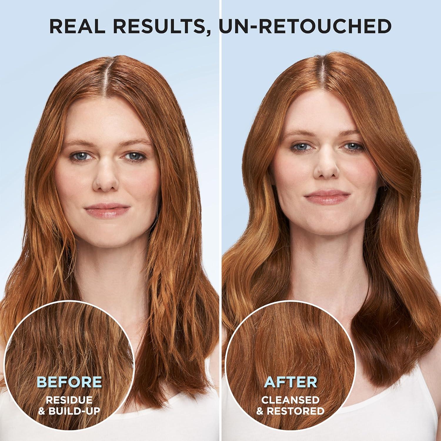 Set Champú y Acondicionador Sin Sulfatos L'Oreal Paris EverPure 226g