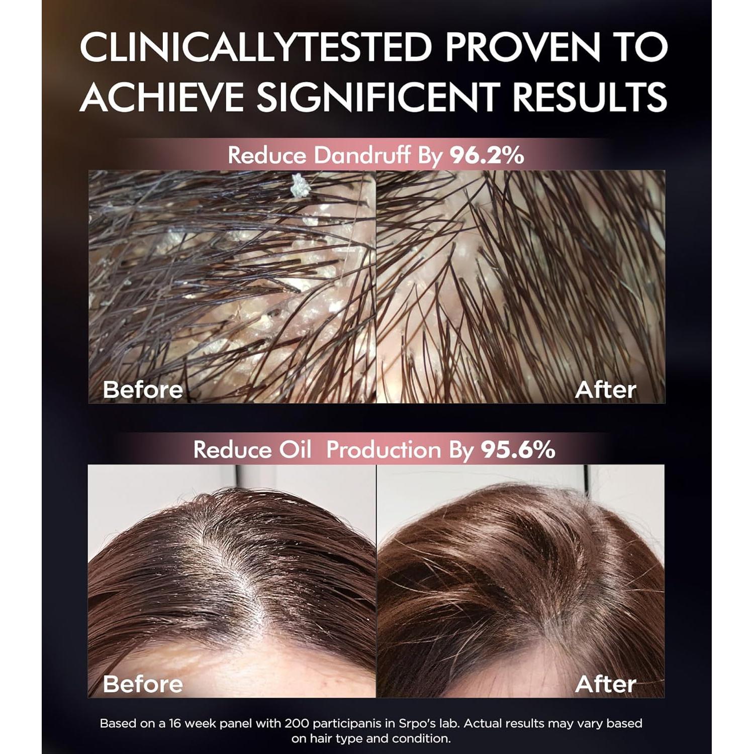 Juego de Champú y Acondicionador Srripo Biotina 2 x 500ml