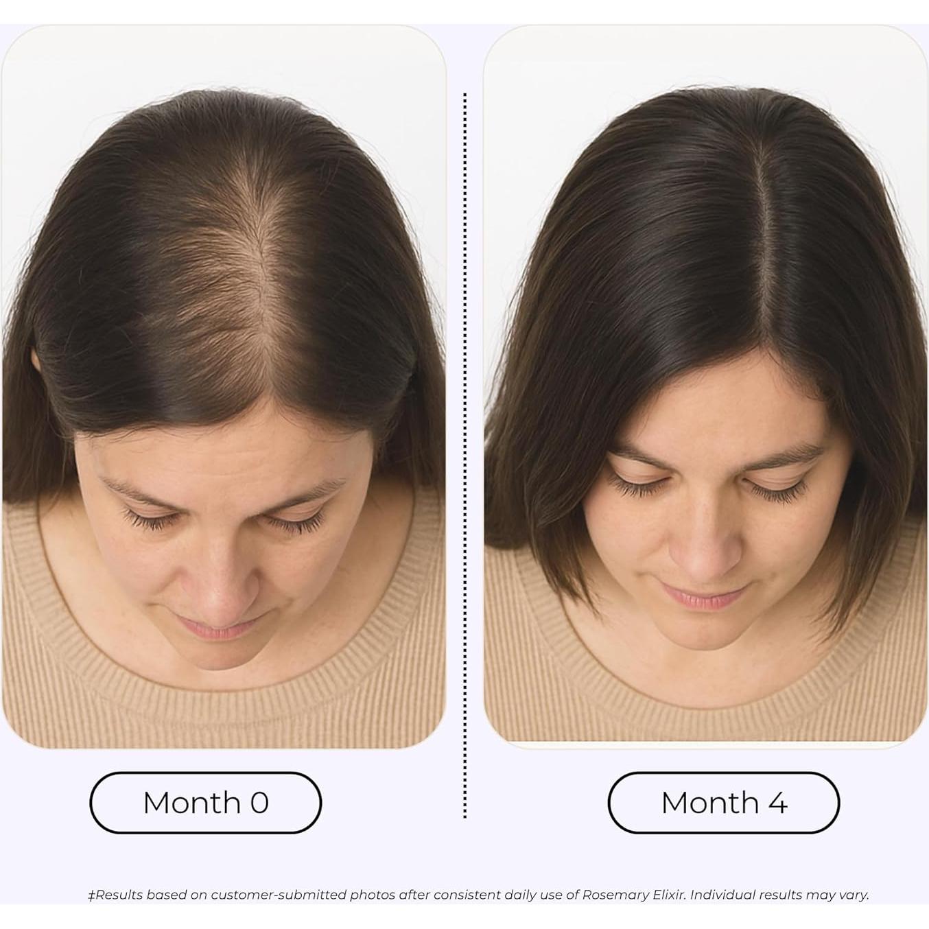 Elixir de Romero Growplex 59ml - Aceite para Cuero Cabelludo