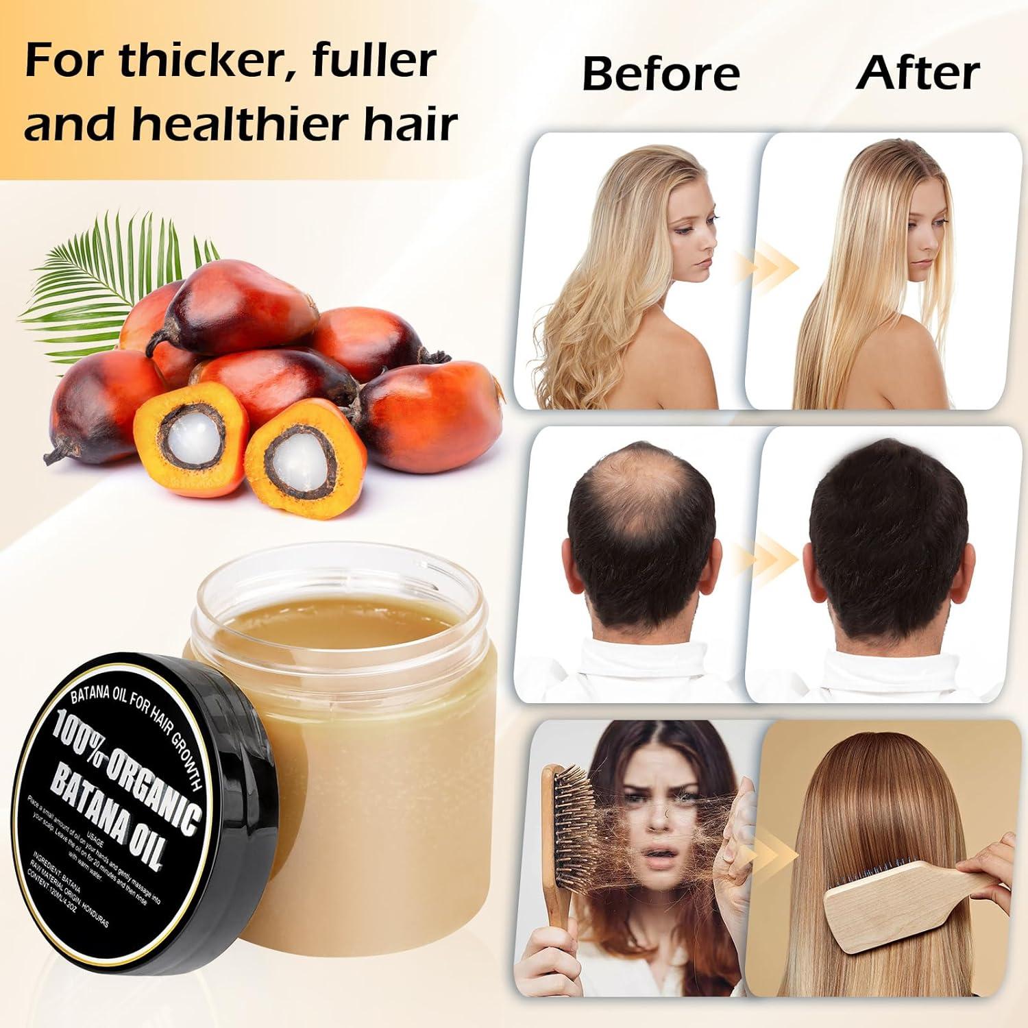 Aceite de Batana Orgánico Crudo Gzarcwvn 120ml - Crecimiento y Nutrición Capilar