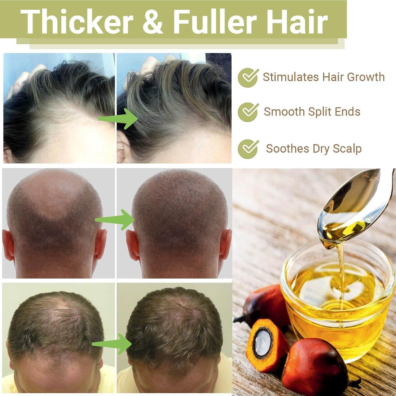 Aceite de Batana Minnah 4 en 1 para Crecimiento del Cabello 100g