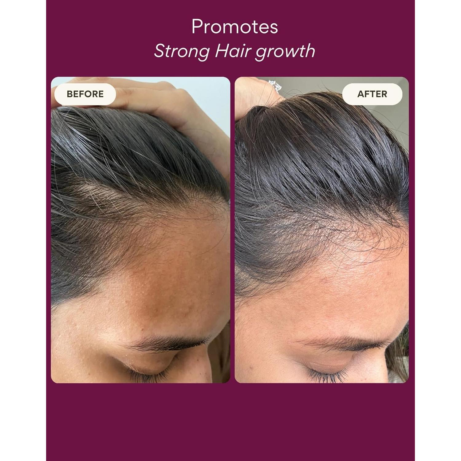 Aceite Natural para Crecimiento del Cabello Resèt 100 ml