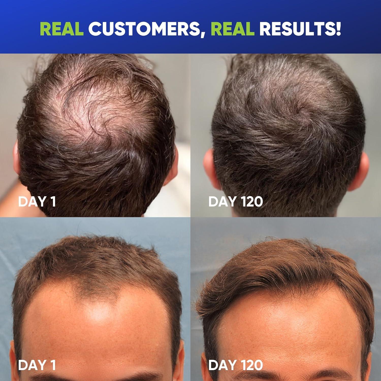 Champú Engrosante Biotina Svvimer 400 ml - Para Hombres