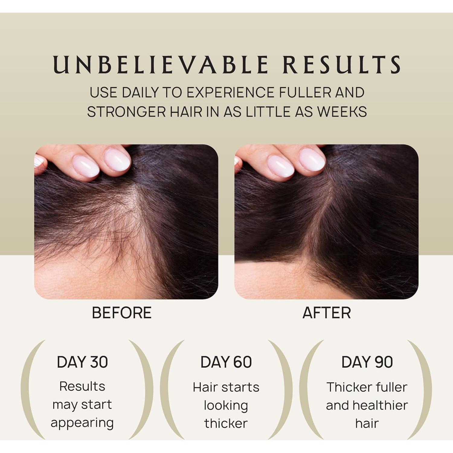 Spray Crecimiento Cabello Lebanta 118ml - Aceite Orgánico Sin Grasa