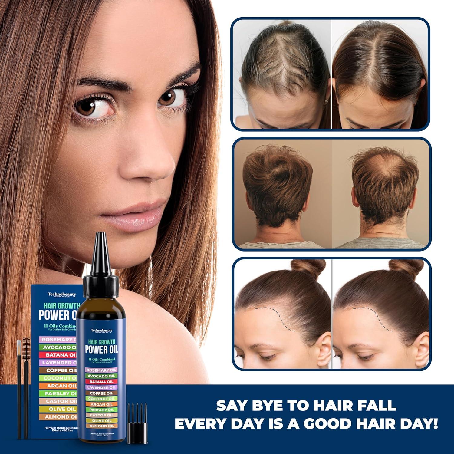 Aceite para el Crecimiento del Cabello Super World Mart 120 ml