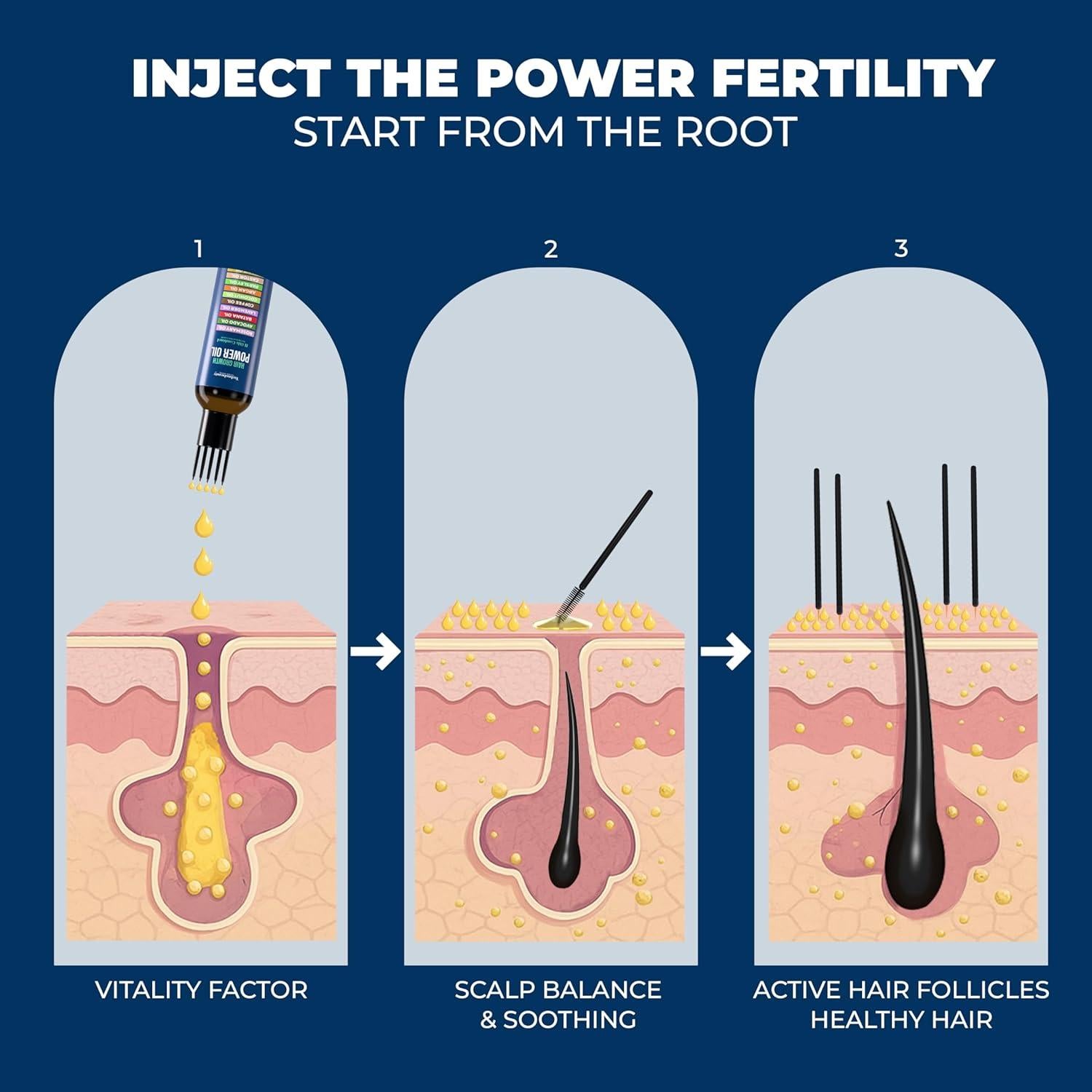 Aceite para el Crecimiento del Cabello Super World Mart 120 ml