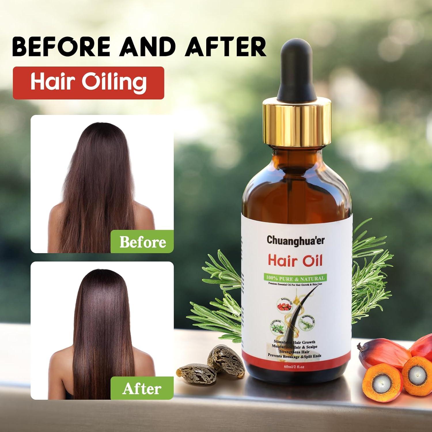 Aceite Natural para el Crecimiento del Cabello Chuanghua'er 132.5g