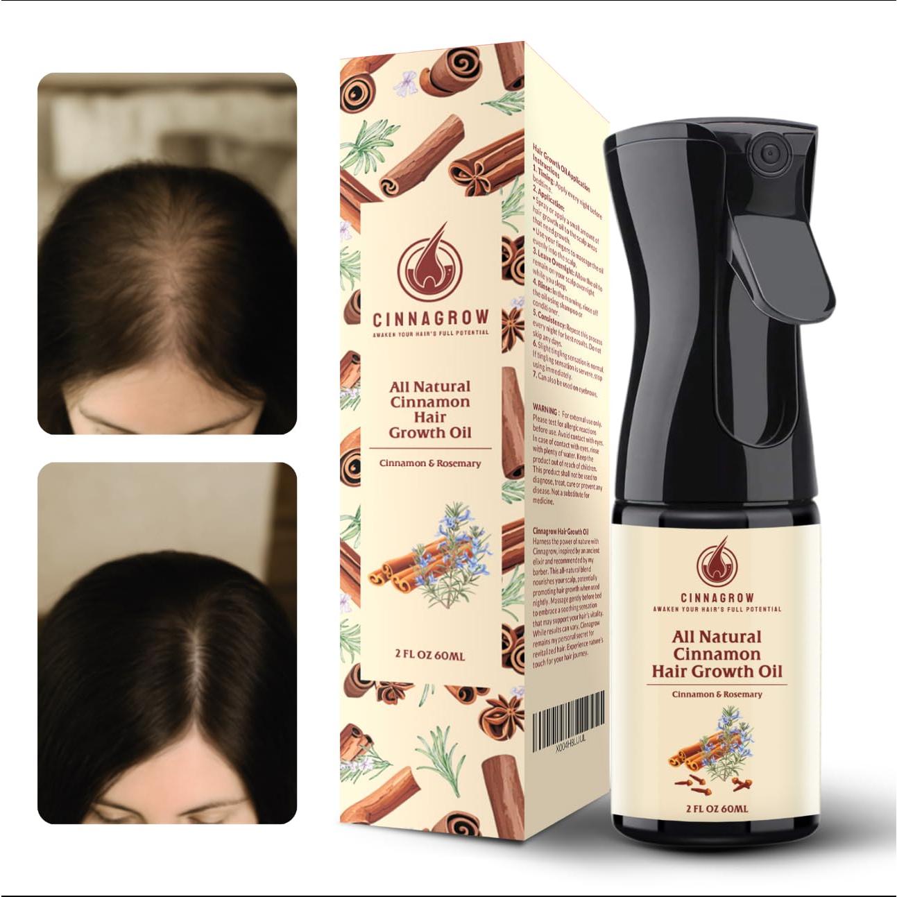 Aceite Natural Cinnagrow para Crecimiento del Cabello 60 ml