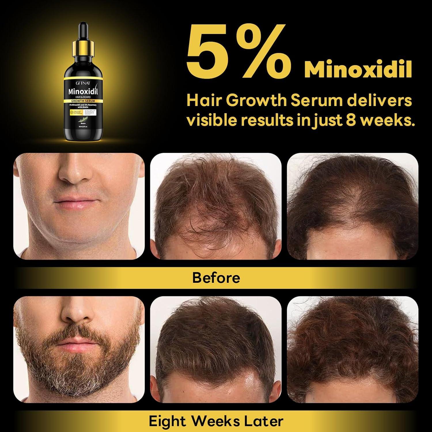 Suero de Crecimiento Capilar 5% Minoxidil GFTNAT 120ml
