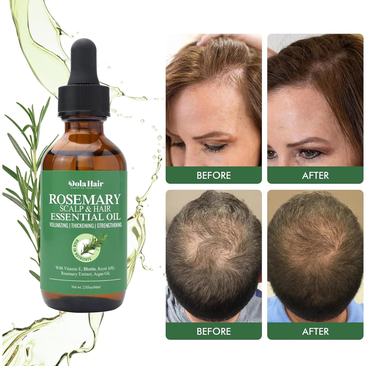 Aceite Esencial de Romero Dolahair 57.5 g - Crecimiento Cabello