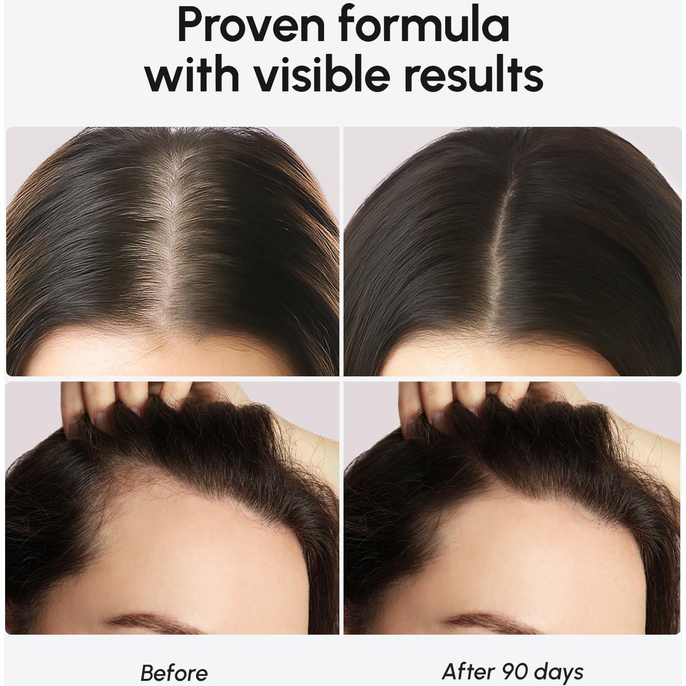 Suero para el Crecimiento del Cabello MAREE - Péptidos y Aceite de Ricino