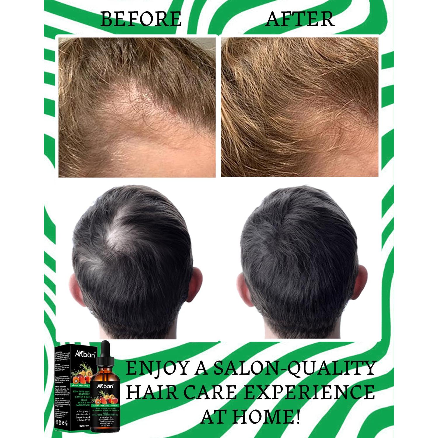 Aceite de Batana y Romero DAIEME 60 ml - Crecimiento Cabello