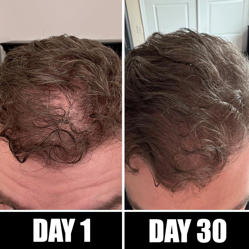 Suero de Crecimiento para Cabello y Barba Pete & Pedro BOOST 60 ml